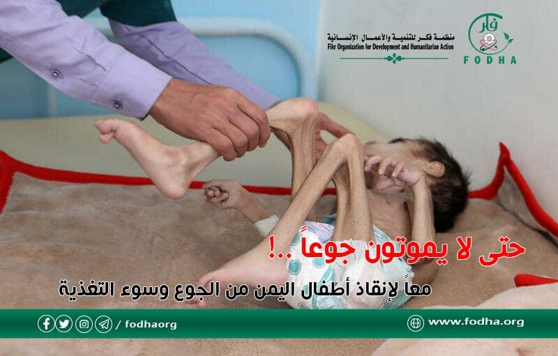 Children of Yemen… starve to death